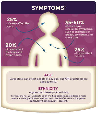 sarcoidosis symptoms